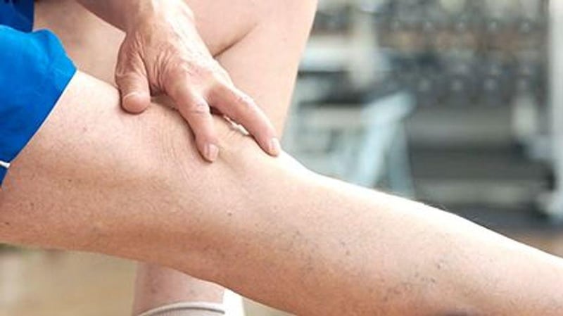News Picture: Lymphedema in Legs Strikes 1 in 3 Female Cancer Survivors