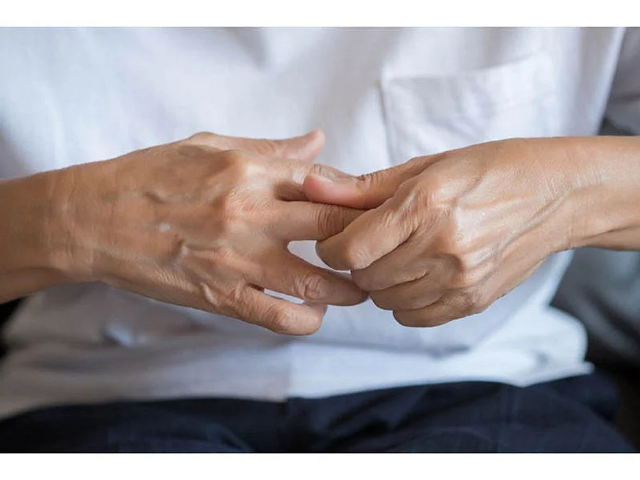 hands of a person with arthritis