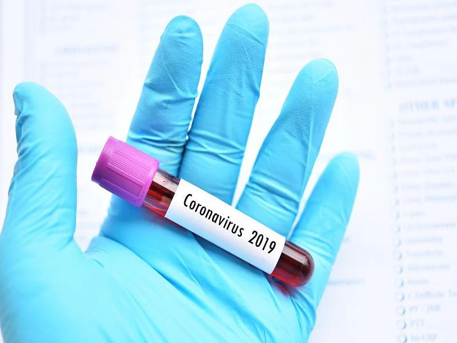 coronavirus 2019