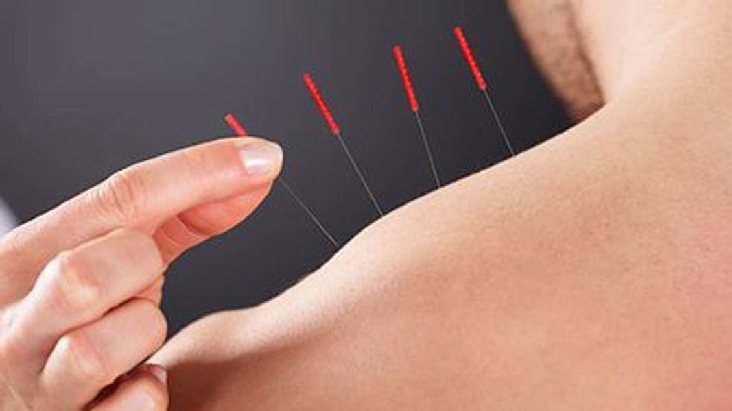 prostatitis acupuncture therapy)
