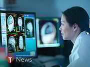 AHA News: What Are Researchers Doing to Stop Dementia?