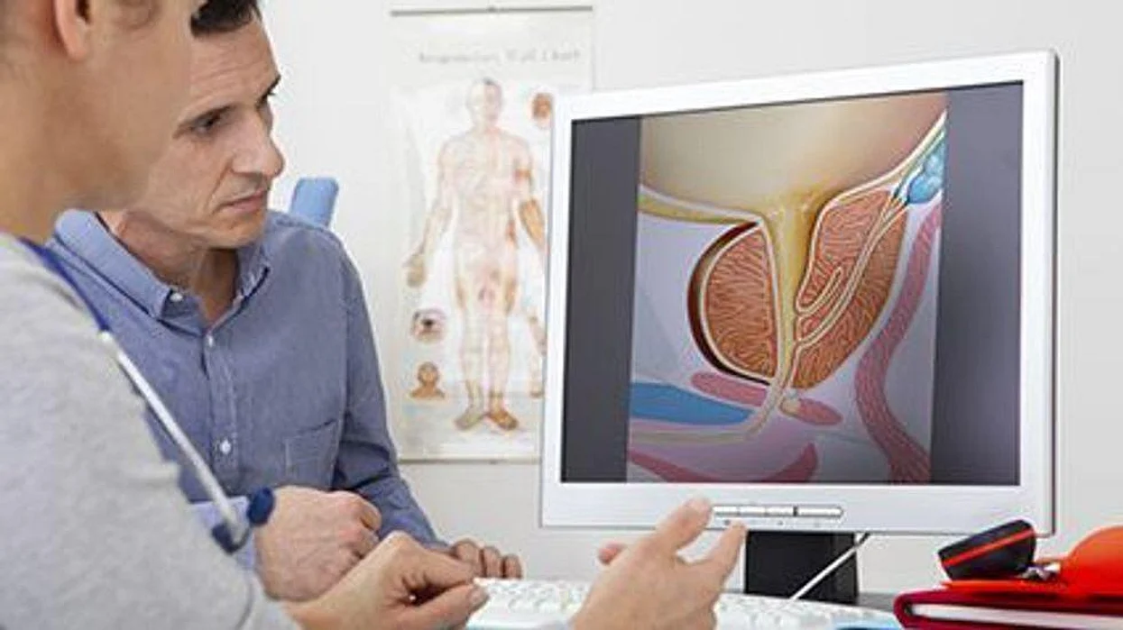 cancer prostate has 2022