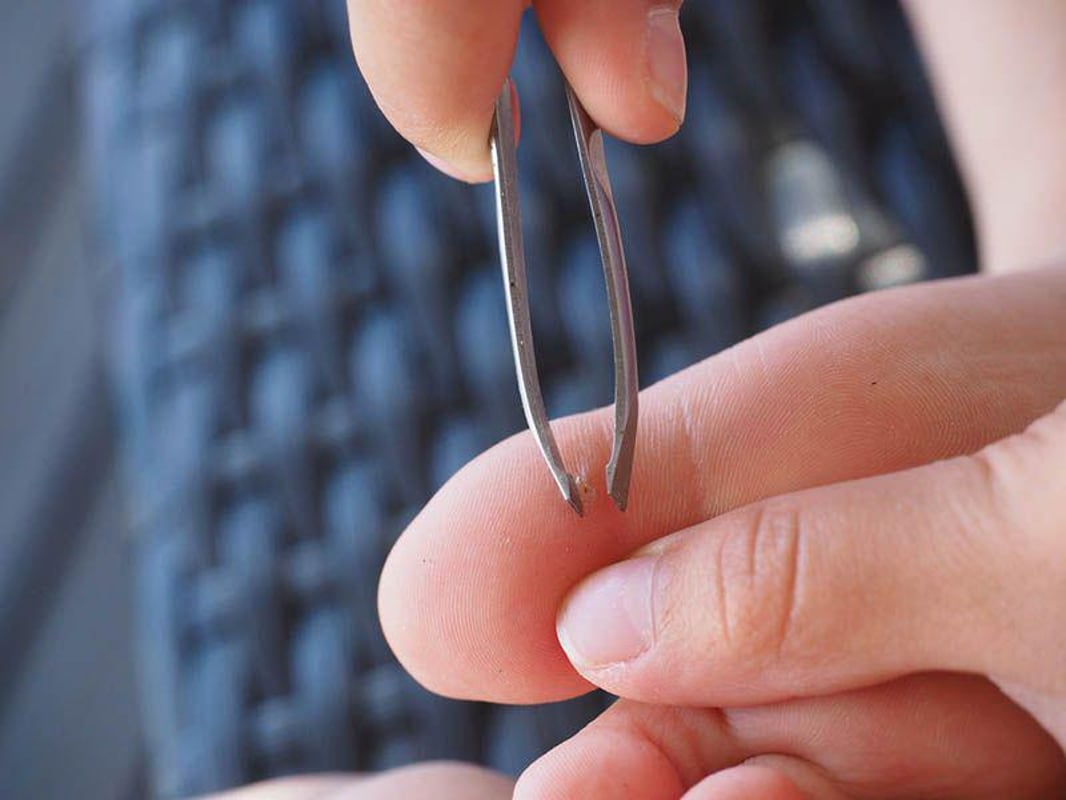 How to Remove a Fishhook From Your Hand Without Making it Worse