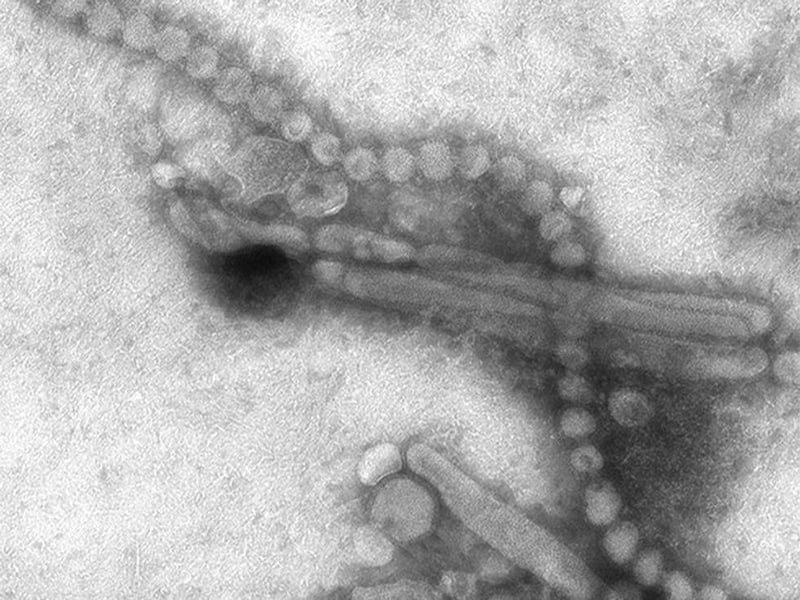 News Picture: COVID Pandemic May Have Driven a Flu Strain Into Extinction
