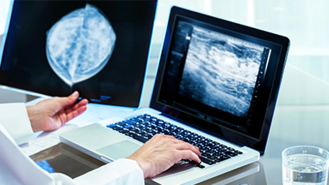 La inteligencia artificial (IA) ayuda a descartar el cáncer en las mujeres con senos densos