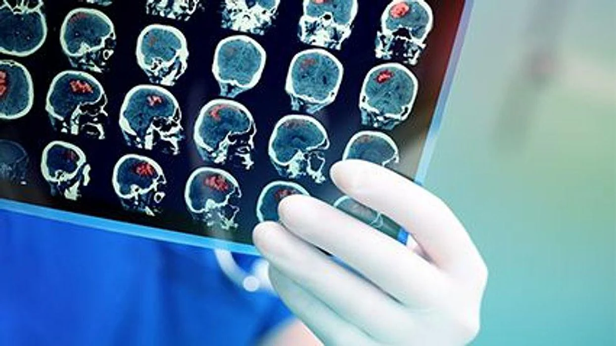 brain scans