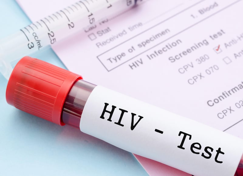 HIV Testing Plummeted During Pandemic