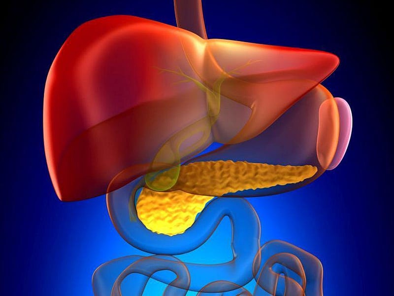 News Picture: Are You at Risk for Pancreatic Cysts?