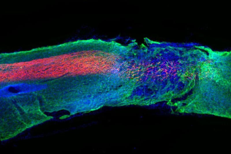 News Picture: Mouse Study Points to Possible Breakthrough Against Spinal Cord Injury