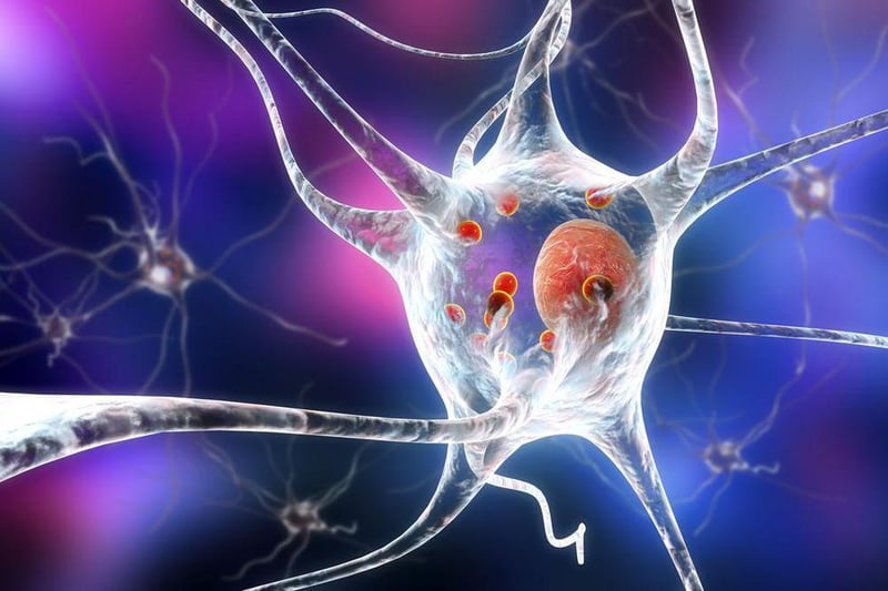 New Insights Into What Might Drive Parkinson's Disease