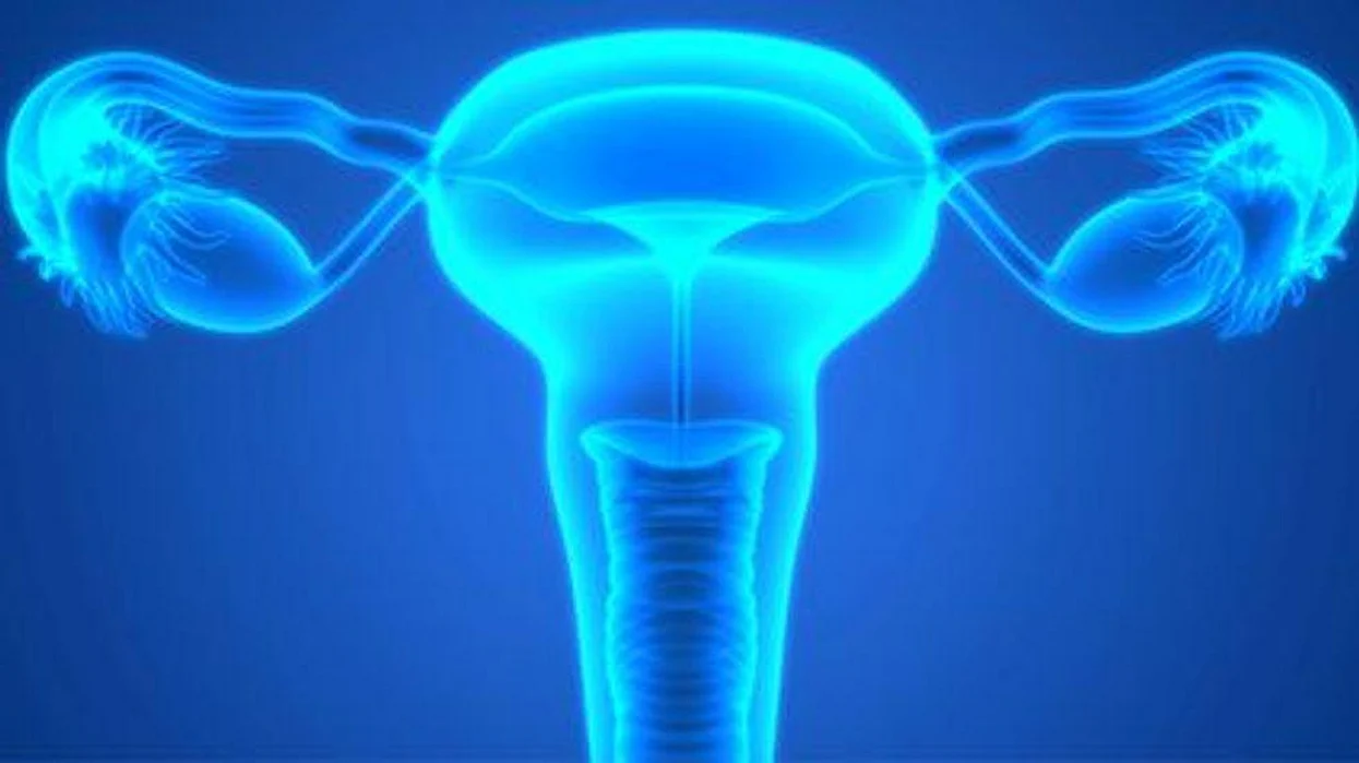 ovarian cancer