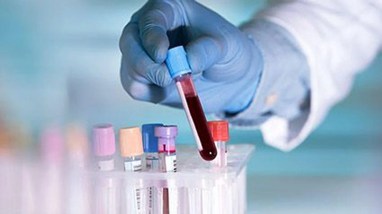 blood samples in a little bottles