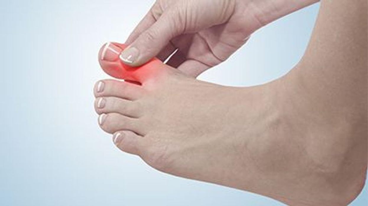 a foot with a red painful toe