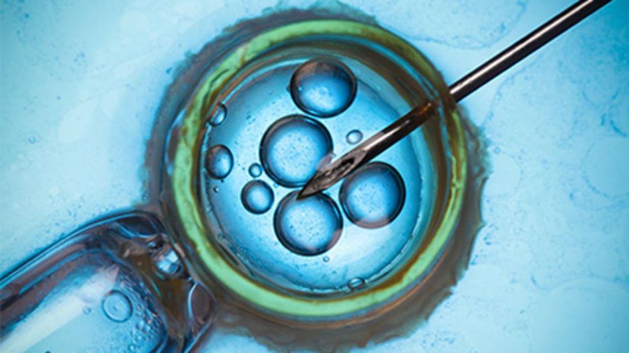 in vitro fertilization, IVF