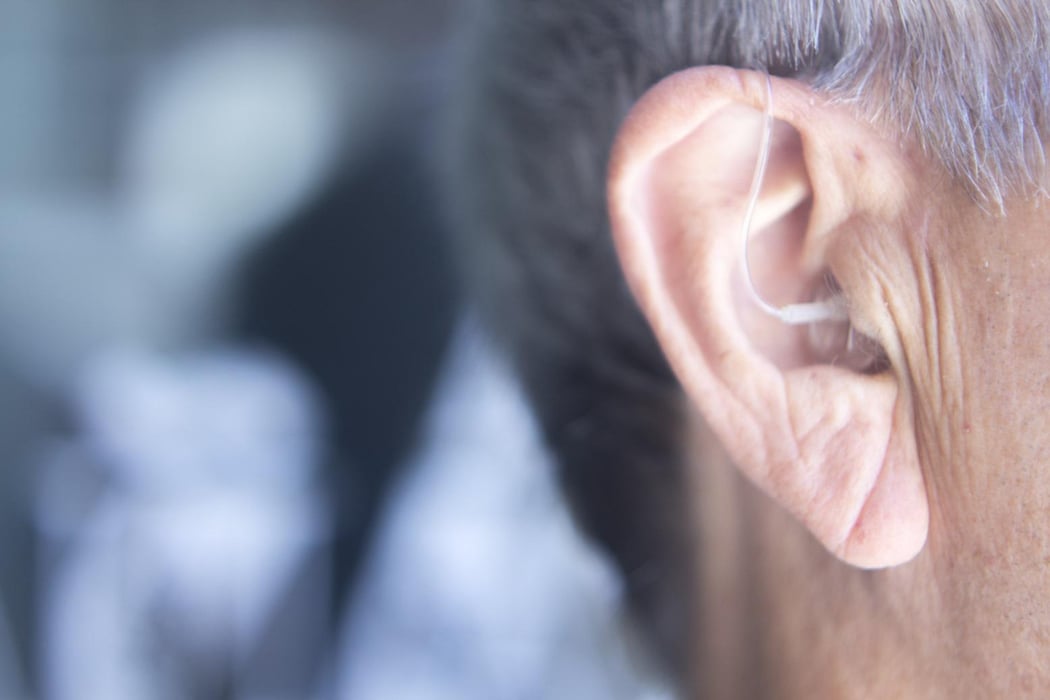 補聴器で難聴の人の認知機能低下が緩やかに――日本人での縦断的検討