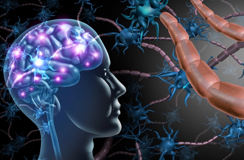 More Evidence Links Mono to Multiple Sclerosis