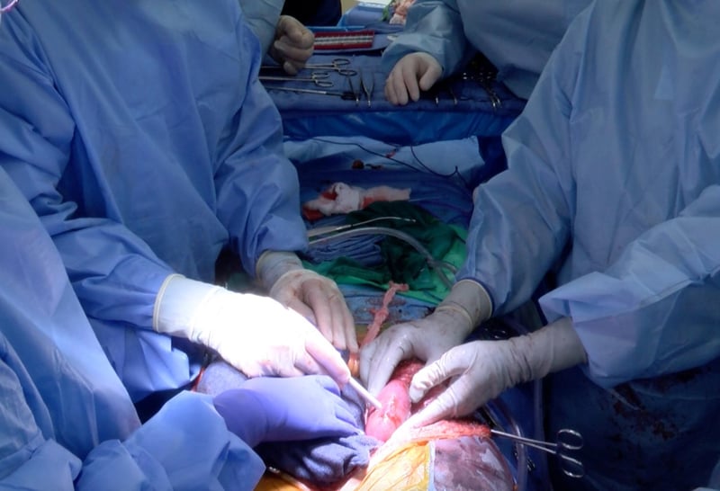 Doctors Transplant Gene-Modified Pig Kidneys Into Brain-Dead Patient