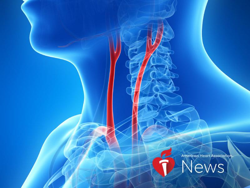 AHA News: Lower Income Linked to Higher Odds of Clogged Neck Arteries