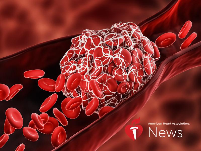 AHA News: COVID-19 Linked to Risk of Dangerous Blood Clots in Stroke Patients