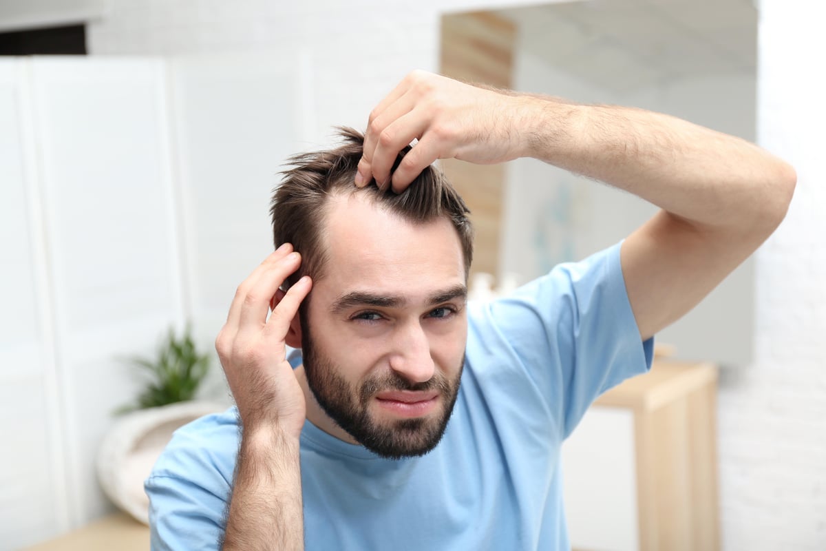 What are the Causes of Men Hair Loss  DermaClinix