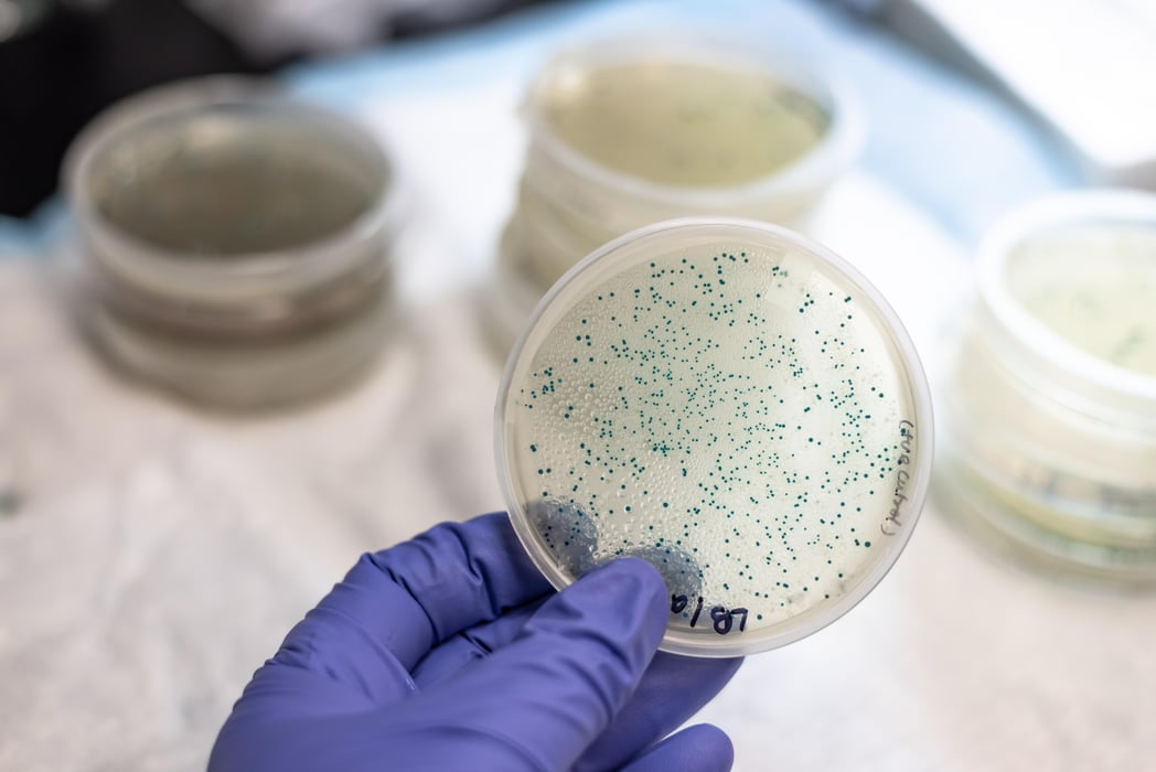 Bacterial culture petri dish lab