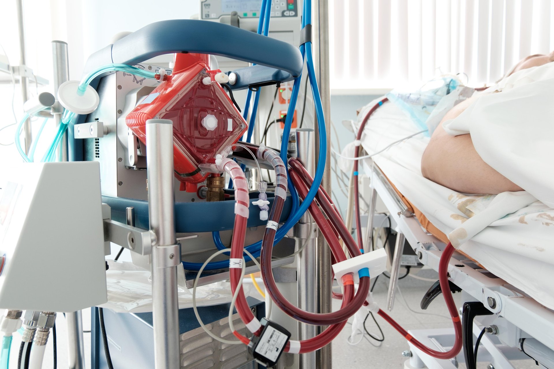 News Picture: ECMO Breathing Support Safe, Effective for Obese Patients in Respiratory Failure