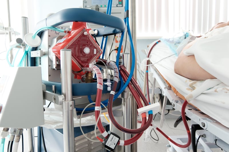 Income a Factor in Whether You Get Lifesaving ECMO Breathing Support: Study