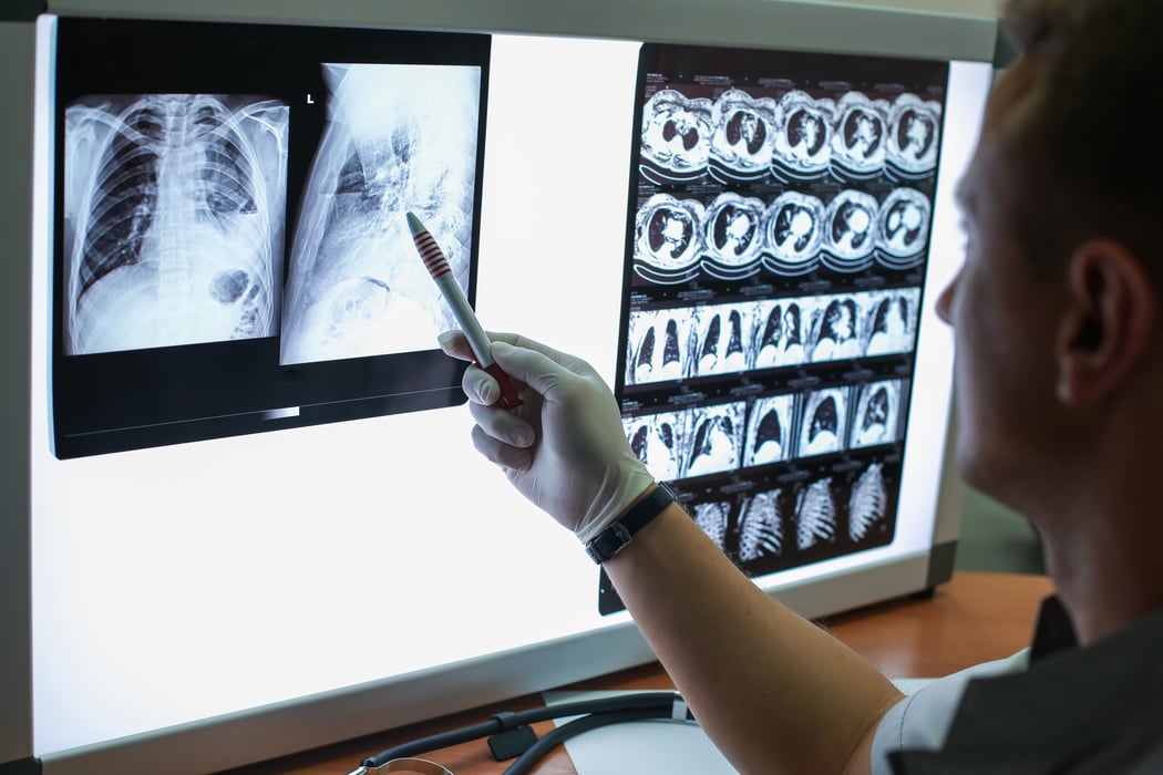 Проведение описания рентгенограмм пациента с ХОБЛ