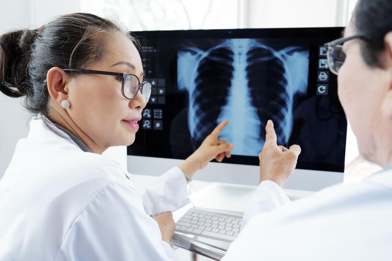 AI May Equal Trained Staff in Spotting TB on Chest X-Rays