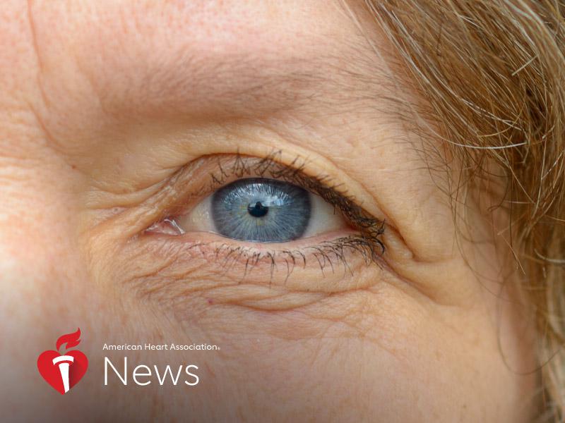 News Picture: AHA News: Damage From Preeclampsia May Be Seen Decades Later In the Eyes