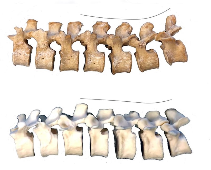 Imagen de noticia: Mirar a los neandertales para explicar el dolor de espalda actual