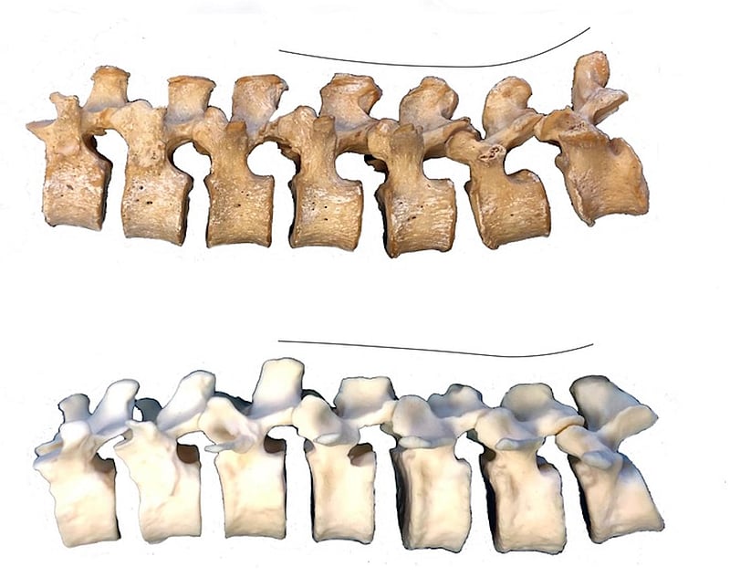 News Picture: Looking to Neanderthals to Explain Today's Lower Back Pain