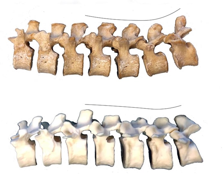 Looking to Neanderthals to Explain Today's Lower Back Pain