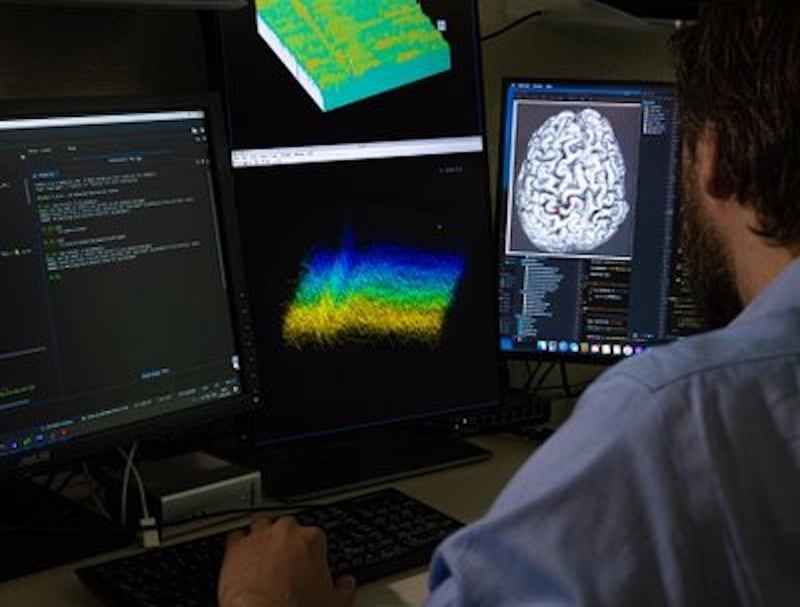 Brain Implant Helps Paralyzed Man Communicate