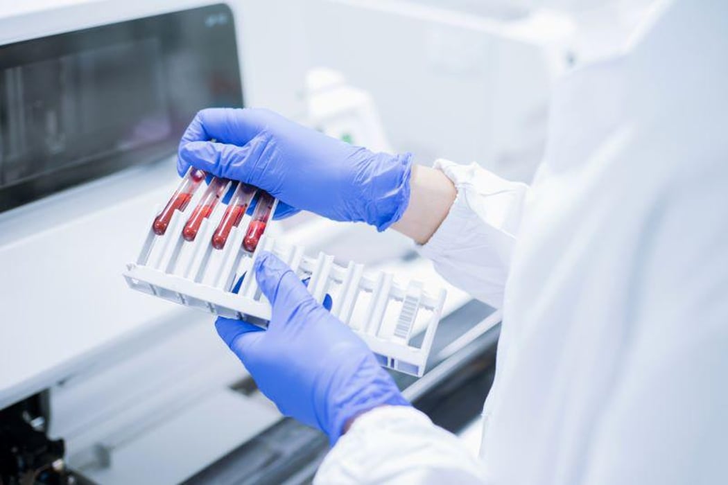 blood samples test tube lab