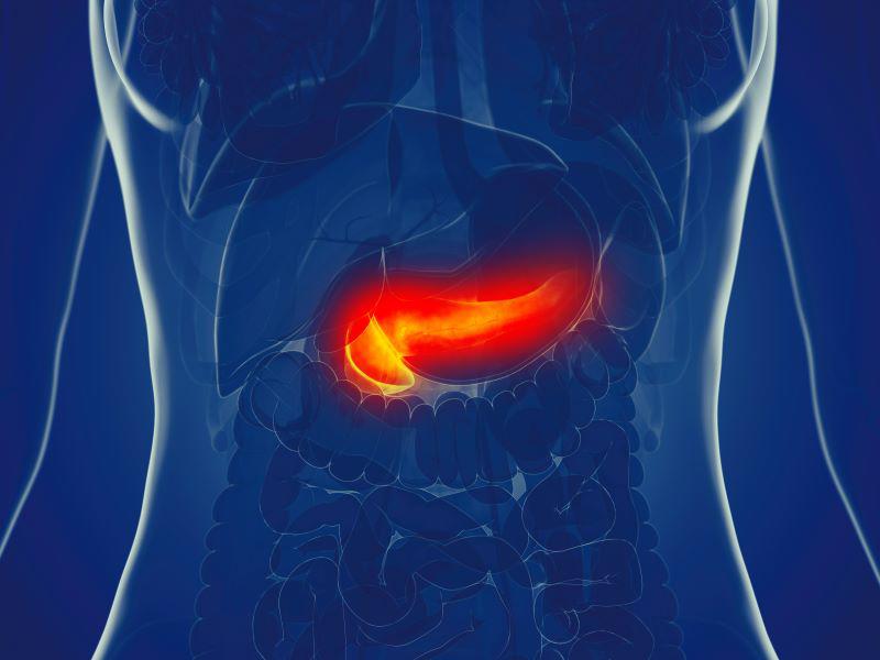 Experimental Therapy May Be New Tool Against Pancreatic Cancer
