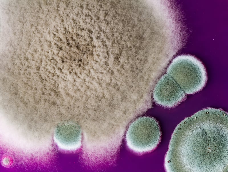 News Picture: Another Health Threat: Drug-Resistant Mold Infections