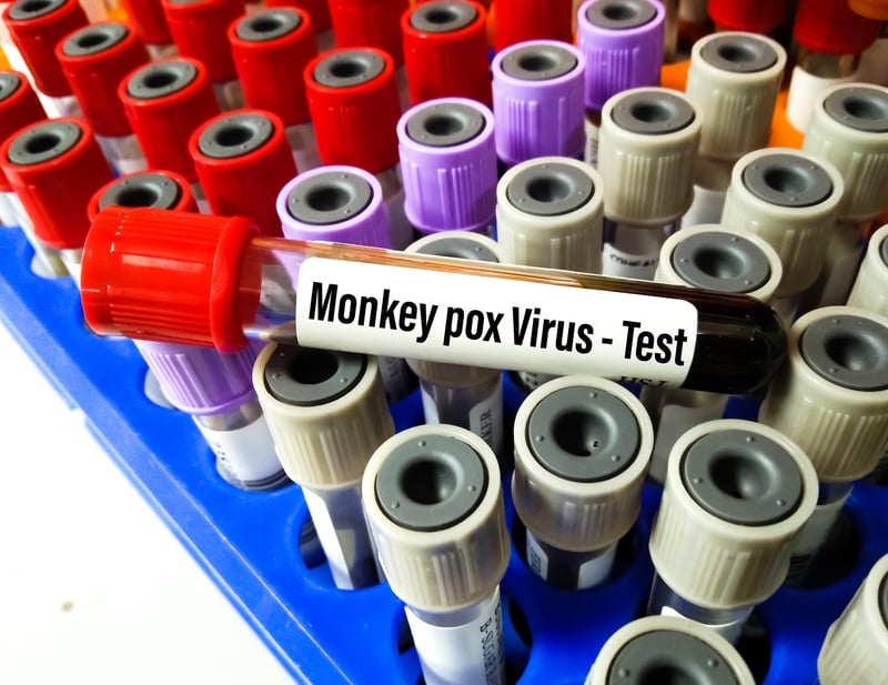 ¿Son efectivos los medicamentos antivirales contra la viruela del simio?
