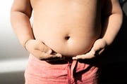 Childhood Obesity Rate in the U.S. Higher Now Than 12 Years Prior