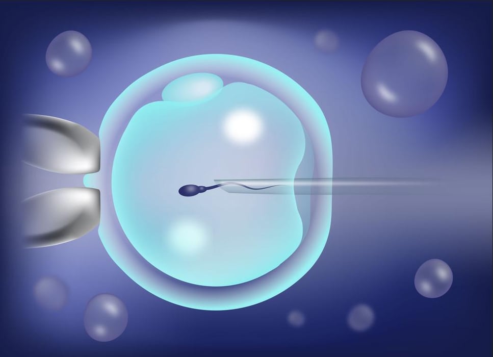Intracytoplasmic Sperm Injection (ICSI) - Consumer Health News | HealthDay