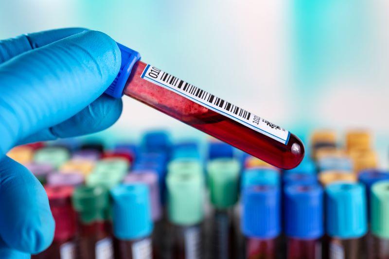 Smaller Blood Draws for Lab Tests Reduce Need for Transfusions
