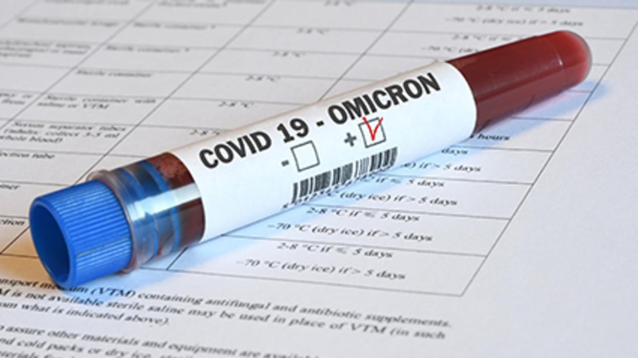 positive omicron covid test