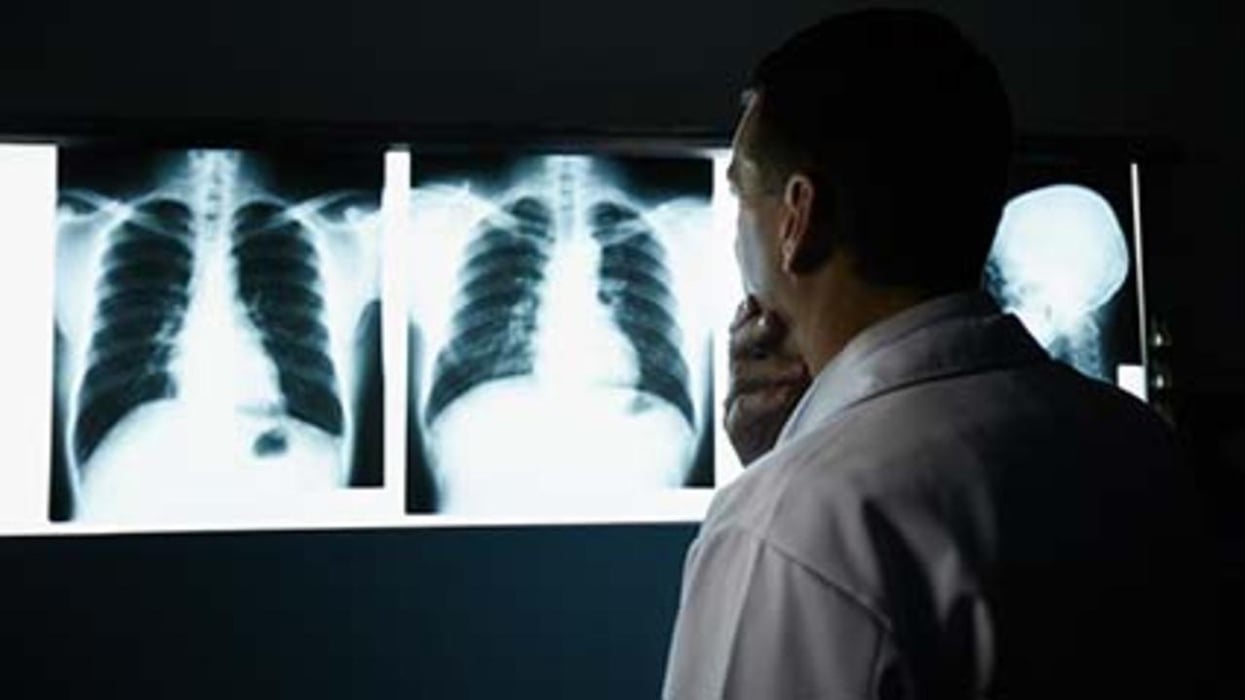 Few American Adults Are Being Screened for Lung Cancer, New Report Finds
