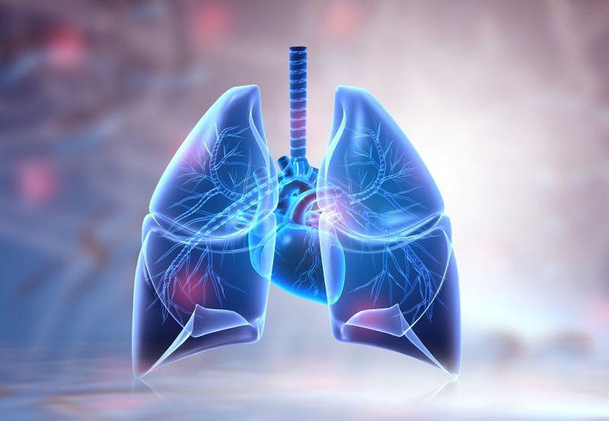 Suspected Bronchiectasis Linked to Mortality With Normal Spirometry