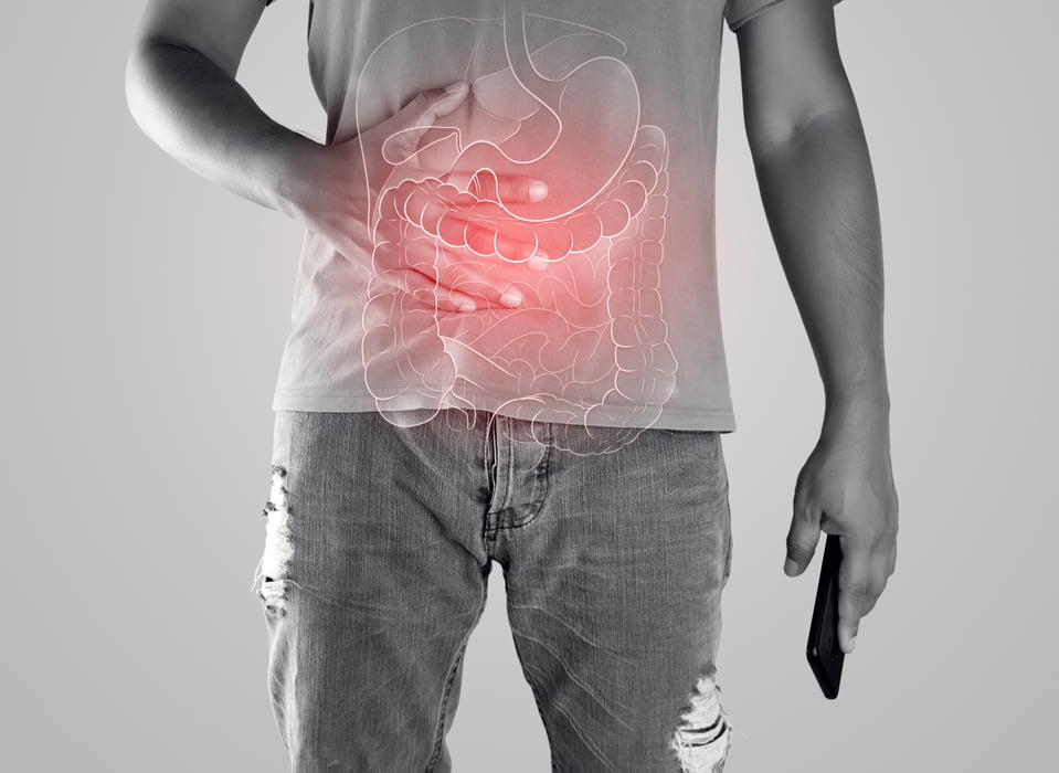 Crohns colitis stomach GERD reflux