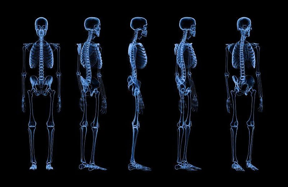 Bone Scintigraphy Can Help ID Cardiac Amyloidosis - Vimarsana News