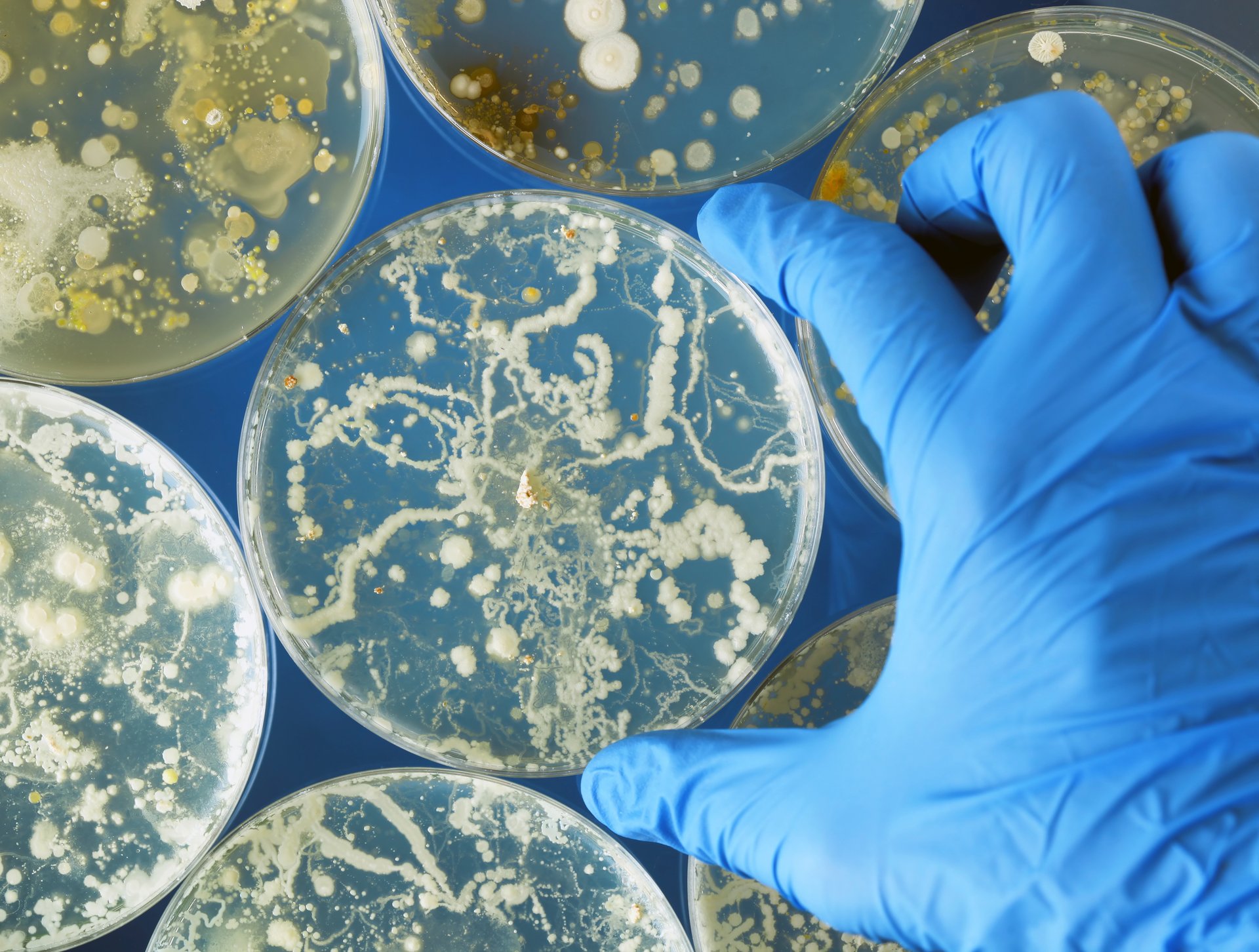 News Picture: Cases of Dangerous Drug-Resistant Fungal Infections Are Spreading