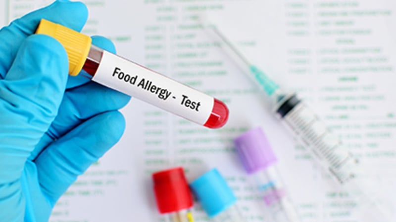 Overuse of Allergy Tests is Causing Anxiety and Unnecessary Food Avoidance, an EMR Review Warns