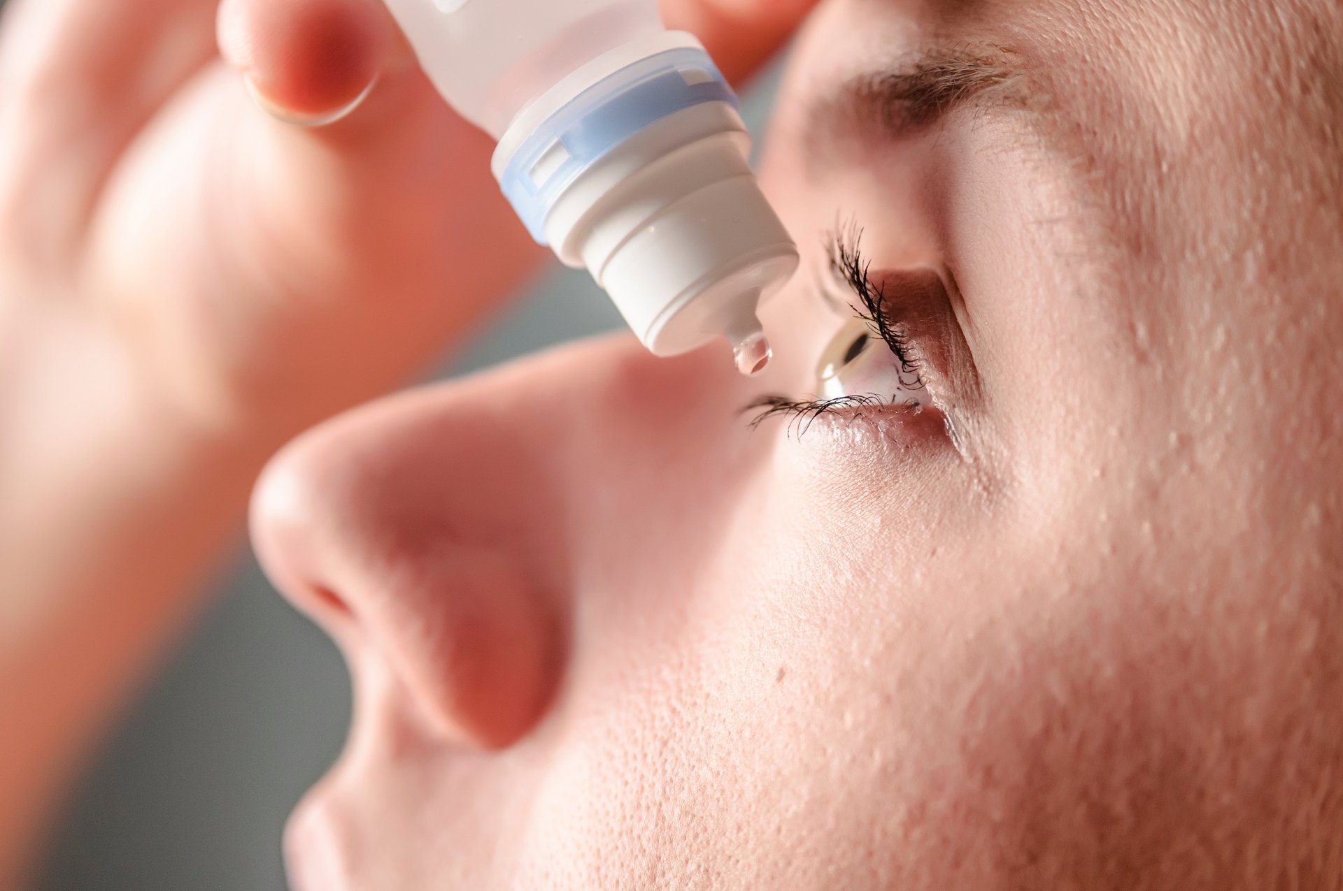 News Picture: Cleveland Case Suggests Tainted Eye Drops Were Harming Vision Months Before CDC Alert