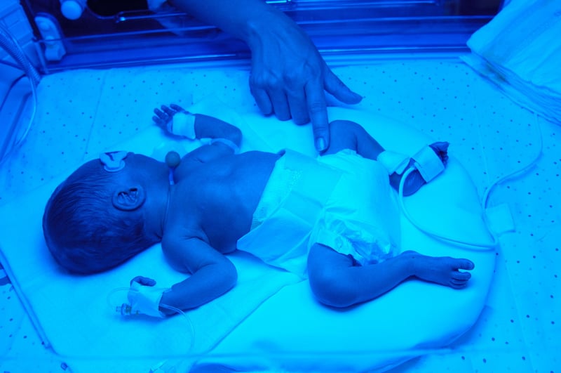 Future of 'Artificial Wombs' for Human Preemies to Be Weighed by FDA Advisors